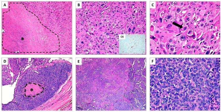 https://cdn.ncbi.nlm.nih.gov/pmc/blobs/2928/8267688/31eead966f1f/cancers-13-03200-g001.jpg