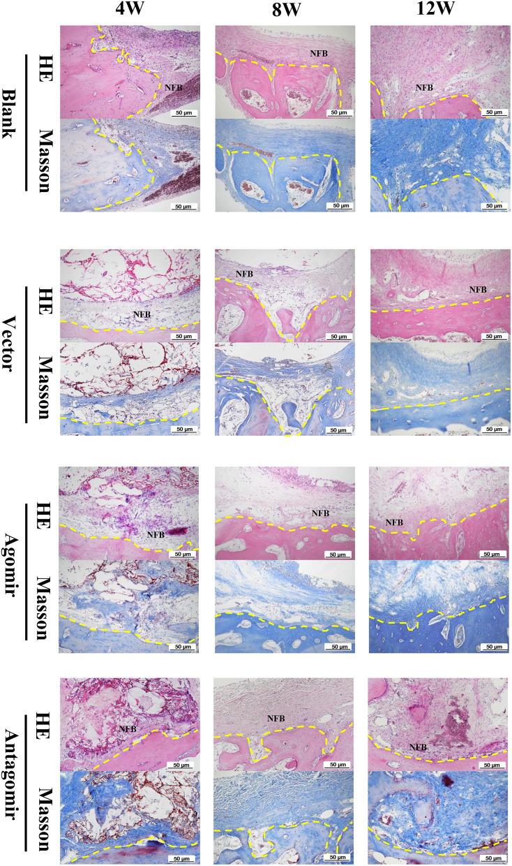 https://cdn.ncbi.nlm.nih.gov/pmc/blobs/2937/11622683/6717f27ade51/IJN-19-12939-g0012.jpg