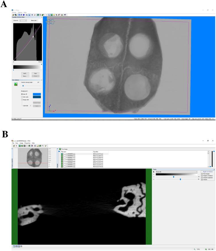 https://cdn.ncbi.nlm.nih.gov/pmc/blobs/2937/11622683/9a80f0a05bd4/IJN-19-12939-g0010.jpg
