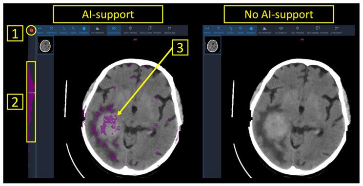 https://cdn.ncbi.nlm.nih.gov/pmc/blobs/293b/8871235/1e4423ebeafe/diagnostics-12-00452-g001.jpg