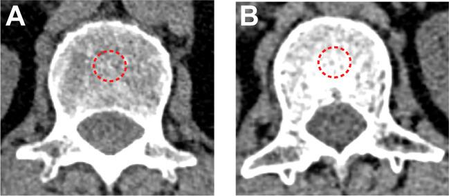 https://cdn.ncbi.nlm.nih.gov/pmc/blobs/293c/11063287/1b1cfc06a7c4/fimmu-15-1332303-g001.jpg