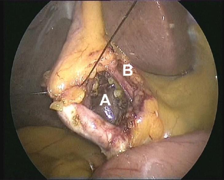 https://cdn.ncbi.nlm.nih.gov/pmc/blobs/293c/3002000/8548323f3a5c/JMAS-7-17-g006.jpg