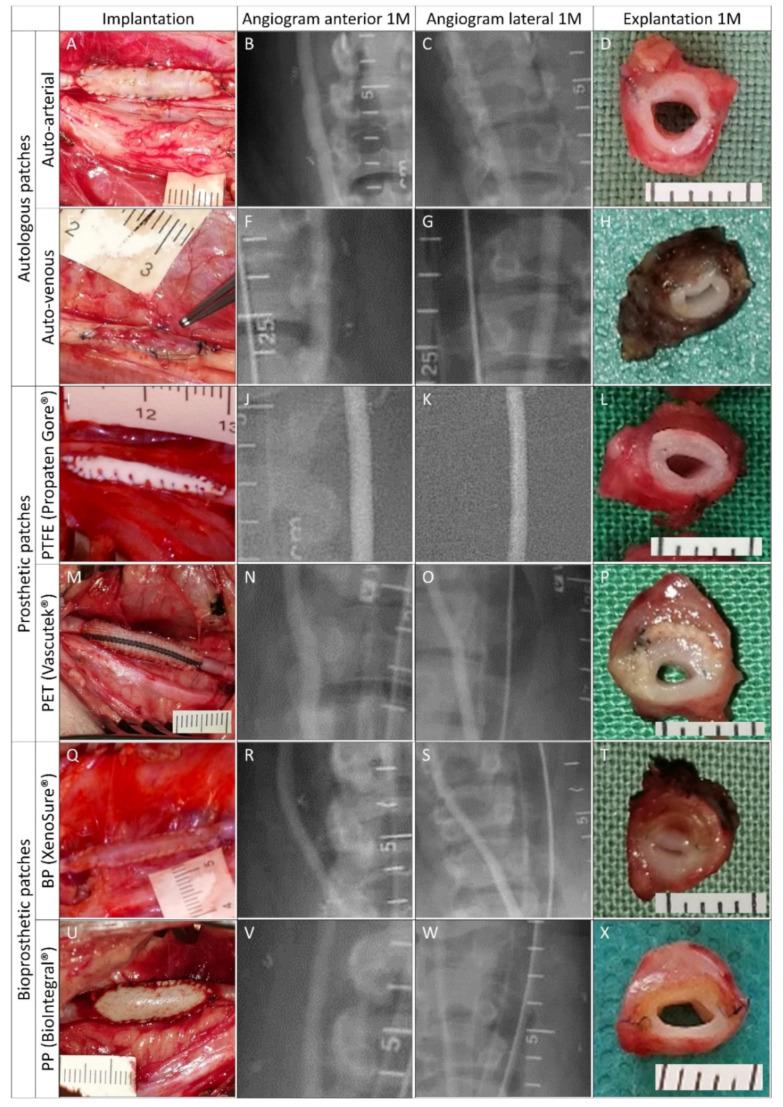 https://cdn.ncbi.nlm.nih.gov/pmc/blobs/2944/8954945/54089969a4aa/ijms-23-03310-g005.jpg