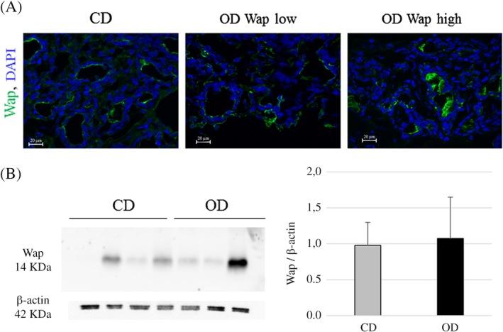 https://cdn.ncbi.nlm.nih.gov/pmc/blobs/2947/6790954/4116cb0ba81f/DVDY-248-948-g006.jpg