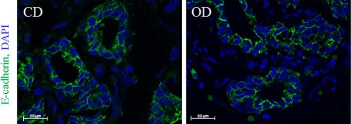 https://cdn.ncbi.nlm.nih.gov/pmc/blobs/2947/6790954/88a93eb70217/DVDY-248-948-g008.jpg