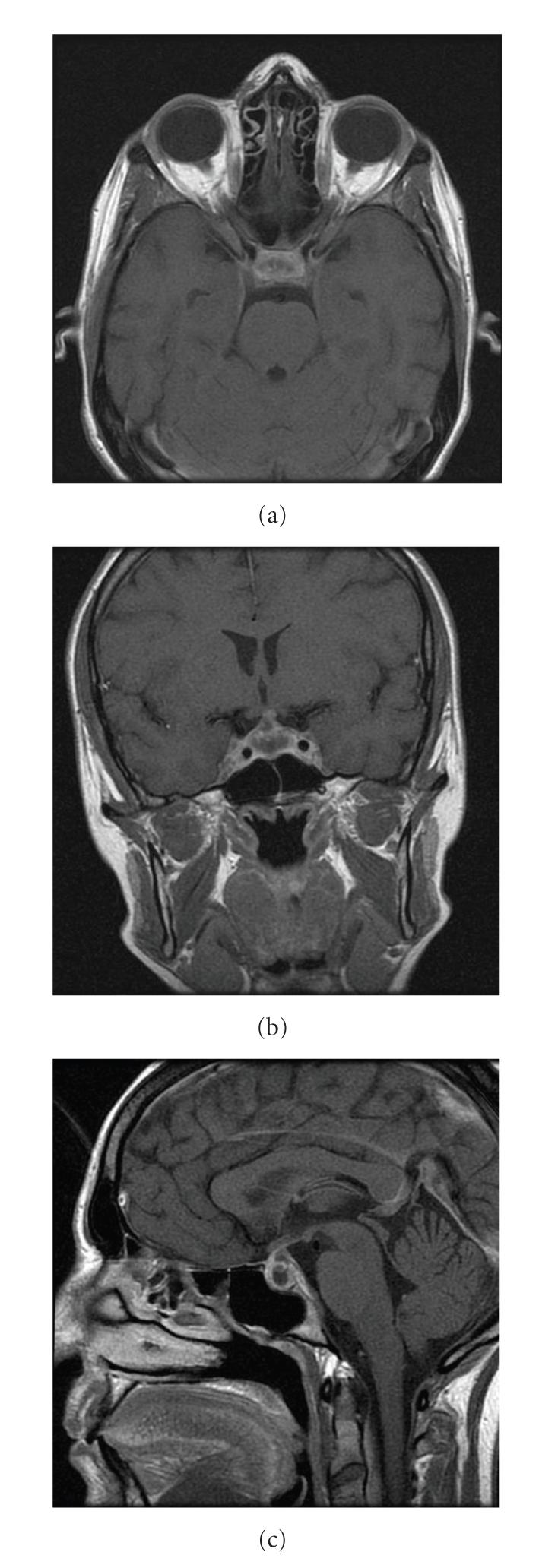 https://cdn.ncbi.nlm.nih.gov/pmc/blobs/2949/2910471/73c357478c5c/JO2010-195323.001.jpg