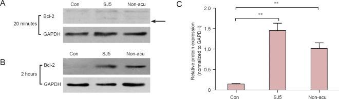 https://cdn.ncbi.nlm.nih.gov/pmc/blobs/294b/4810996/814b730d01f3/NRR-11-305-g008.jpg
