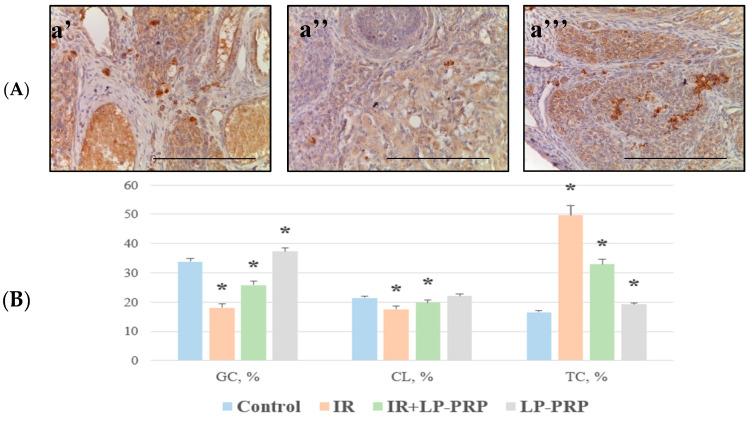https://cdn.ncbi.nlm.nih.gov/pmc/blobs/2953/11432445/119bba430ca8/ijms-25-10115-g004.jpg