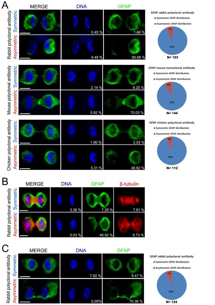 https://cdn.ncbi.nlm.nih.gov/pmc/blobs/295a/4783030/df36b1f7f7e9/pone.0151274.g002.jpg