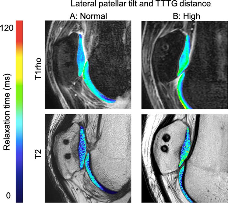 https://cdn.ncbi.nlm.nih.gov/pmc/blobs/295d/8763754/a5800a4a1189/256_2021_3832_Fig4_HTML.jpg