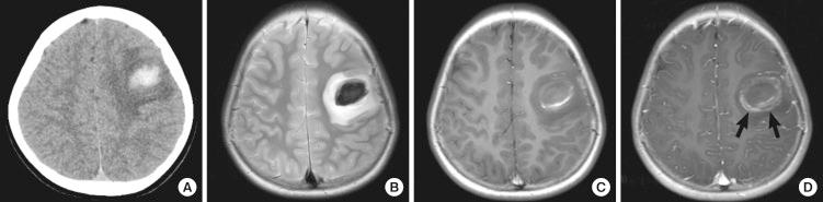 https://cdn.ncbi.nlm.nih.gov/pmc/blobs/295e/3492682/b3849f3a6983/jkms-27-1428-g001.jpg
