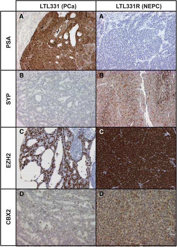 https://cdn.ncbi.nlm.nih.gov/pmc/blobs/2961/4391120/7f7f742e3a99/13148_2015_74_Fig3_HTML.jpg