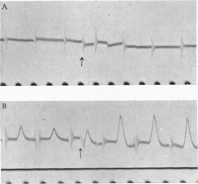 https://cdn.ncbi.nlm.nih.gov/pmc/blobs/2962/1393543/3761dace81aa/jphysiol01552-0021-a.jpg