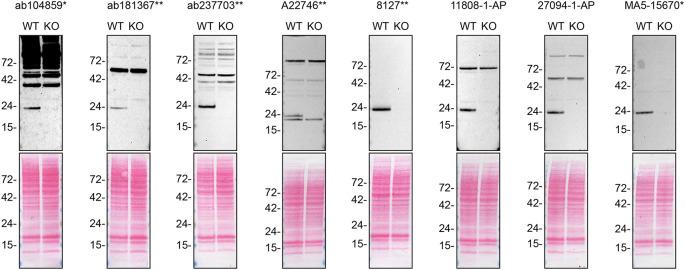 https://cdn.ncbi.nlm.nih.gov/pmc/blobs/2965/12174638/1974fa2d8c58/f1000research-13-171489-g0000.jpg
