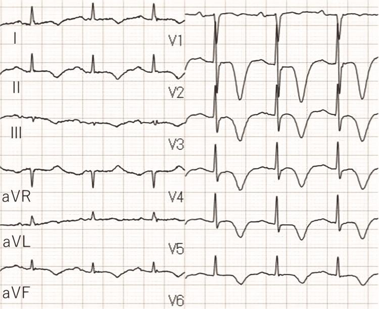https://cdn.ncbi.nlm.nih.gov/pmc/blobs/2965/9236697/b60db6b217b2/cureus-0014-00000025389-i04.jpg