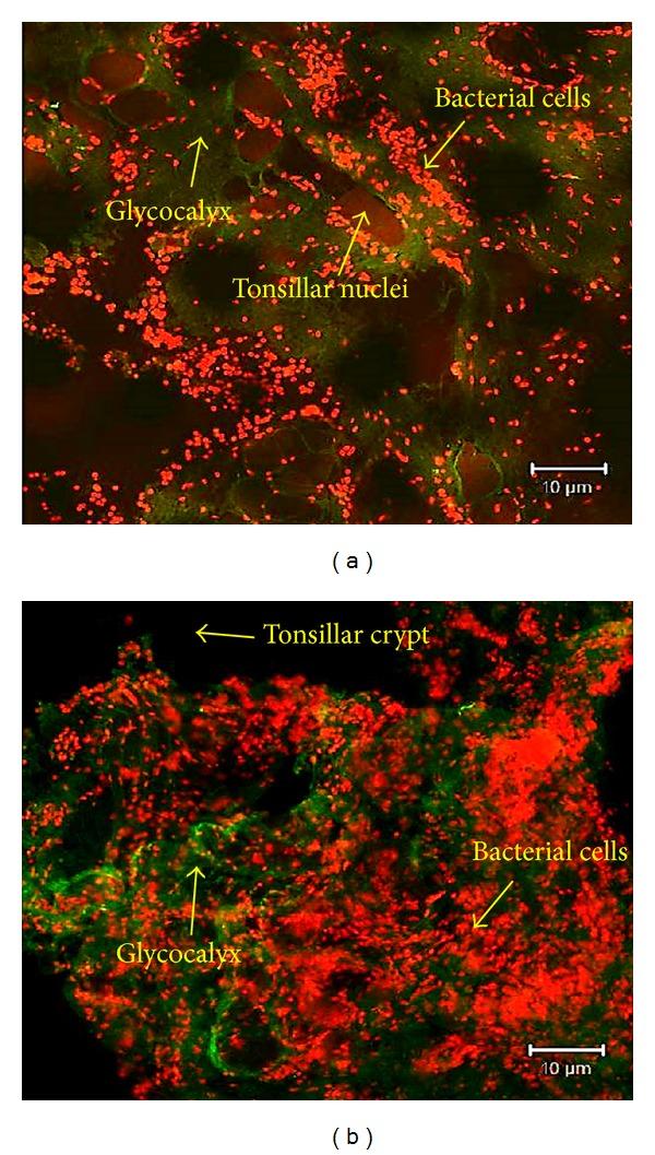 https://cdn.ncbi.nlm.nih.gov/pmc/blobs/2966/3886491/5527ac21a44a/IJOL2013-408238.004.jpg