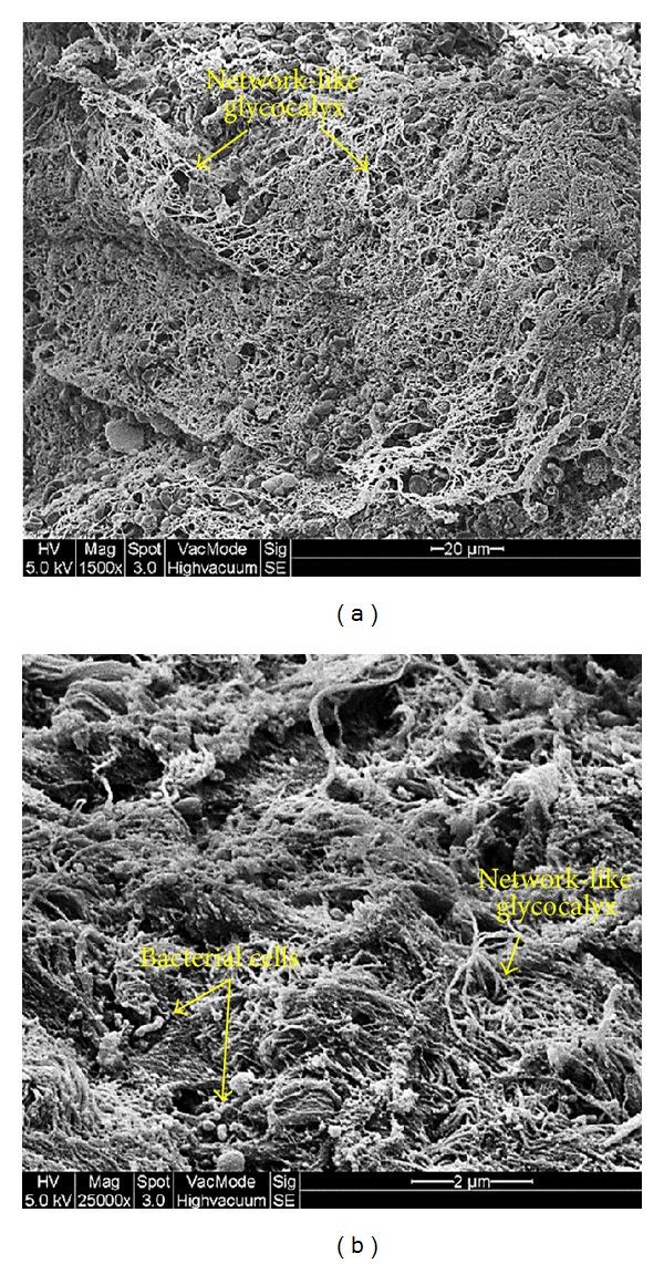 https://cdn.ncbi.nlm.nih.gov/pmc/blobs/2966/3886491/ccf98df0eb12/IJOL2013-408238.003.jpg
