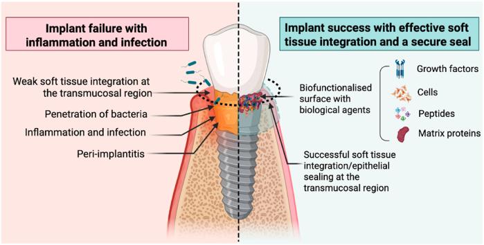 https://cdn.ncbi.nlm.nih.gov/pmc/blobs/2968/12313982/9638117b3d2c/ga1.jpg