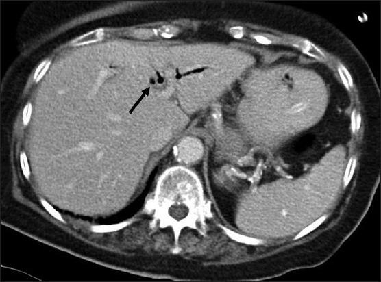 https://cdn.ncbi.nlm.nih.gov/pmc/blobs/296a/3889000/4e3533bccb15/JSTCR-5-27-g003.jpg