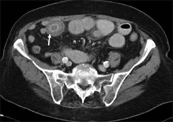 https://cdn.ncbi.nlm.nih.gov/pmc/blobs/296a/3889000/920e79fb16de/JSTCR-5-27-g004.jpg