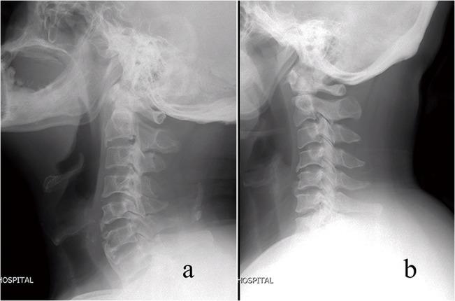 https://cdn.ncbi.nlm.nih.gov/pmc/blobs/2986/4556618/35e2f89ce2a9/pone.0136042.g001.jpg
