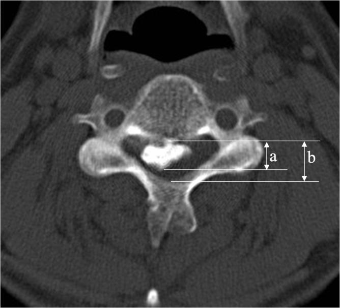 https://cdn.ncbi.nlm.nih.gov/pmc/blobs/2986/4556618/435cf01aab28/pone.0136042.g004.jpg