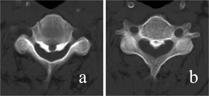 https://cdn.ncbi.nlm.nih.gov/pmc/blobs/2986/4556618/75daa2752e50/pone.0136042.g003.jpg