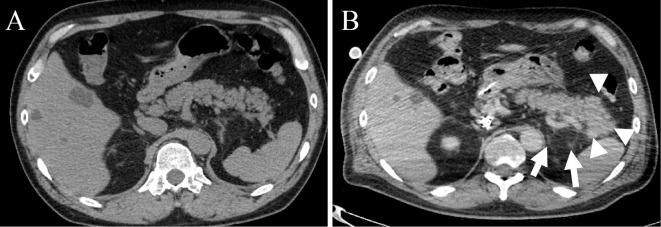 https://cdn.ncbi.nlm.nih.gov/pmc/blobs/298f/7725617/23e730bc470c/1349-7235-59-2903-g002.jpg