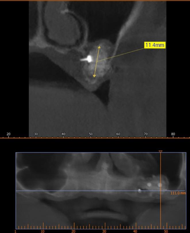 https://cdn.ncbi.nlm.nih.gov/pmc/blobs/2993/12082275/7476df9a180c/f1000research-14-180711-g0010.jpg