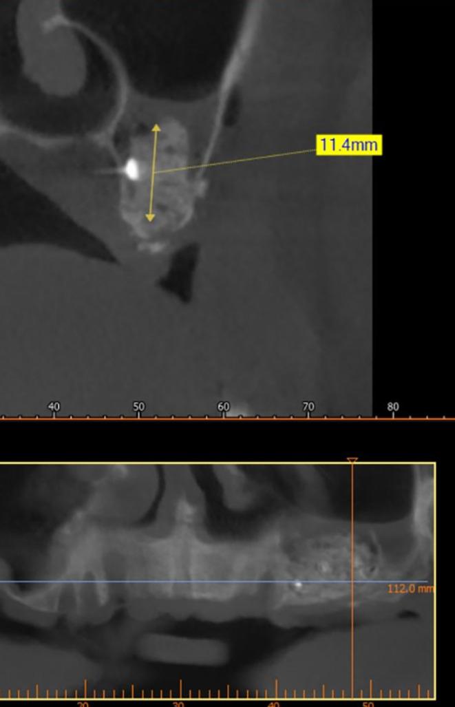 https://cdn.ncbi.nlm.nih.gov/pmc/blobs/2993/12082275/b479da24eec3/f1000research-14-180711-g0009.jpg