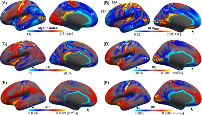 https://cdn.ncbi.nlm.nih.gov/pmc/blobs/2995/9805124/51cc258bbf2b/MRM-88-2485-g008.jpg