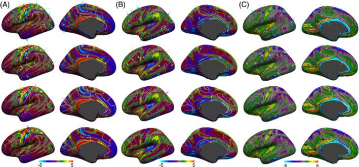 https://cdn.ncbi.nlm.nih.gov/pmc/blobs/2995/9805124/f95e0a726b2d/MRM-88-2485-g009.jpg