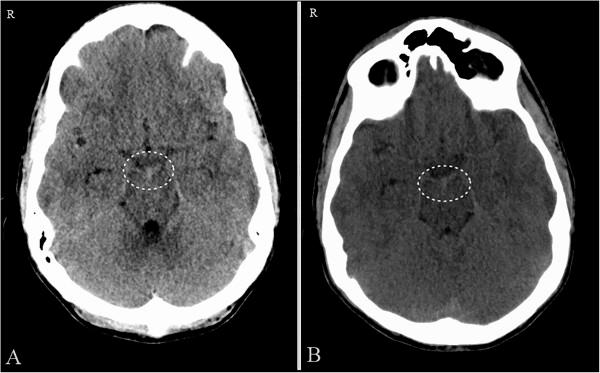 https://cdn.ncbi.nlm.nih.gov/pmc/blobs/2998/4275759/63eb513a9fc4/1752-1947-8-380-1.jpg