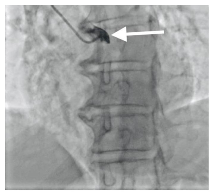 https://cdn.ncbi.nlm.nih.gov/pmc/blobs/29a7/11221453/06f64c342702/jchim-14-02-075f2.jpg