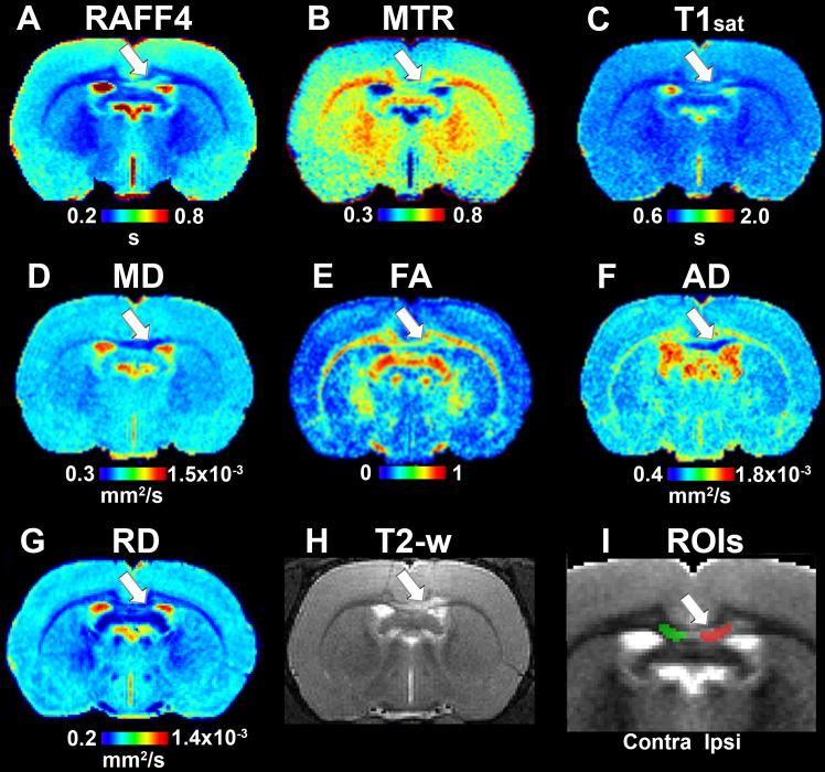 https://cdn.ncbi.nlm.nih.gov/pmc/blobs/29a9/7969884/502d1148bc10/fnins-15-625167-g002.jpg