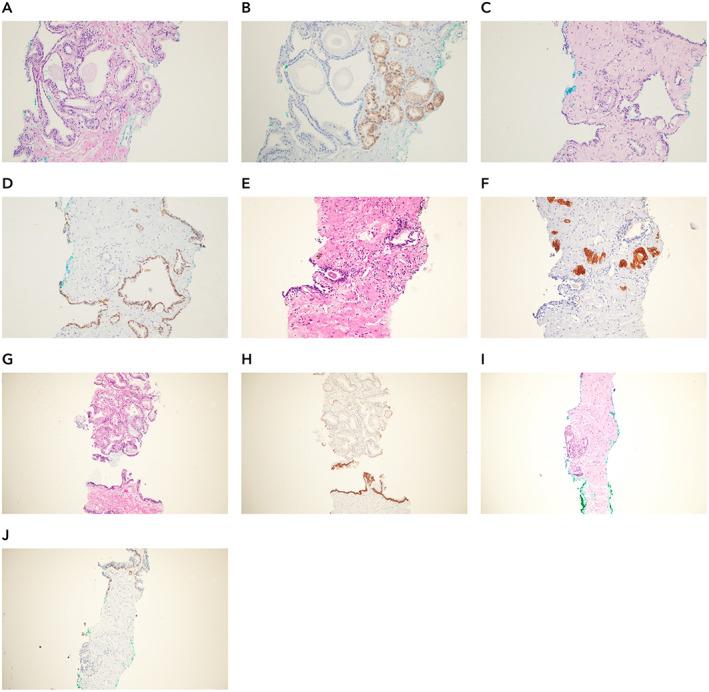 https://cdn.ncbi.nlm.nih.gov/pmc/blobs/29ad/8252036/b6da95e8cb6c/PATH-254-147-g003.jpg
