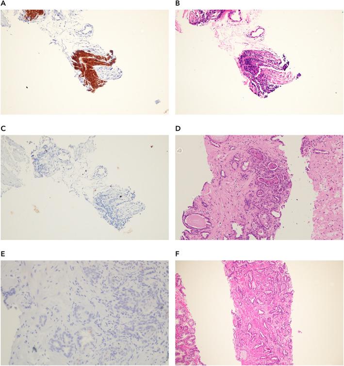 https://cdn.ncbi.nlm.nih.gov/pmc/blobs/29ad/8252036/dd47bc981295/PATH-254-147-g006.jpg