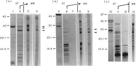 https://cdn.ncbi.nlm.nih.gov/pmc/blobs/29ae/1535745/189c7d2b727a/clinexpimmunol00059-0044-a.jpg