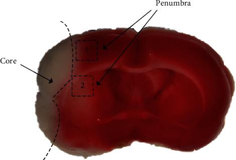 https://cdn.ncbi.nlm.nih.gov/pmc/blobs/29c0/9232306/97b1efb26775/MI2022-1707122.001.jpg