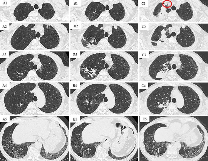 https://cdn.ncbi.nlm.nih.gov/pmc/blobs/29c2/12331295/b29f1dec545e/1349-7235-64-14-2223-g002.jpg