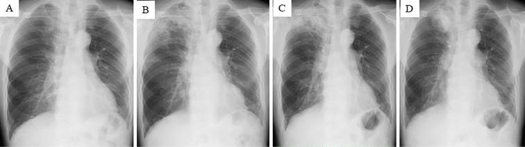 https://cdn.ncbi.nlm.nih.gov/pmc/blobs/29c2/12331295/d187b8b5dcb8/1349-7235-64-14-2223-g001.jpg