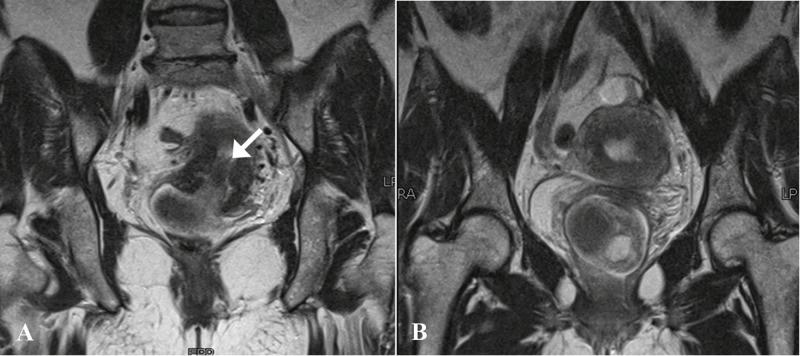 https://cdn.ncbi.nlm.nih.gov/pmc/blobs/29c3/6464492/6f9b19503105/cureus-0011-00000004044-i05.jpg