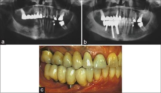 https://cdn.ncbi.nlm.nih.gov/pmc/blobs/29c4/4837771/05da5f967e8c/JIPS-16-116-g006.jpg