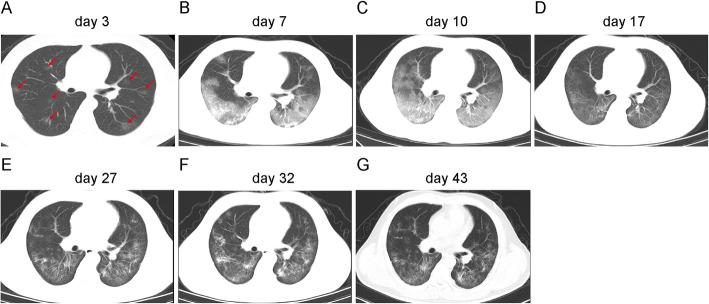 https://cdn.ncbi.nlm.nih.gov/pmc/blobs/29c8/7353777/c3a92c0b81f4/12879_2020_5231_Fig2_HTML.jpg