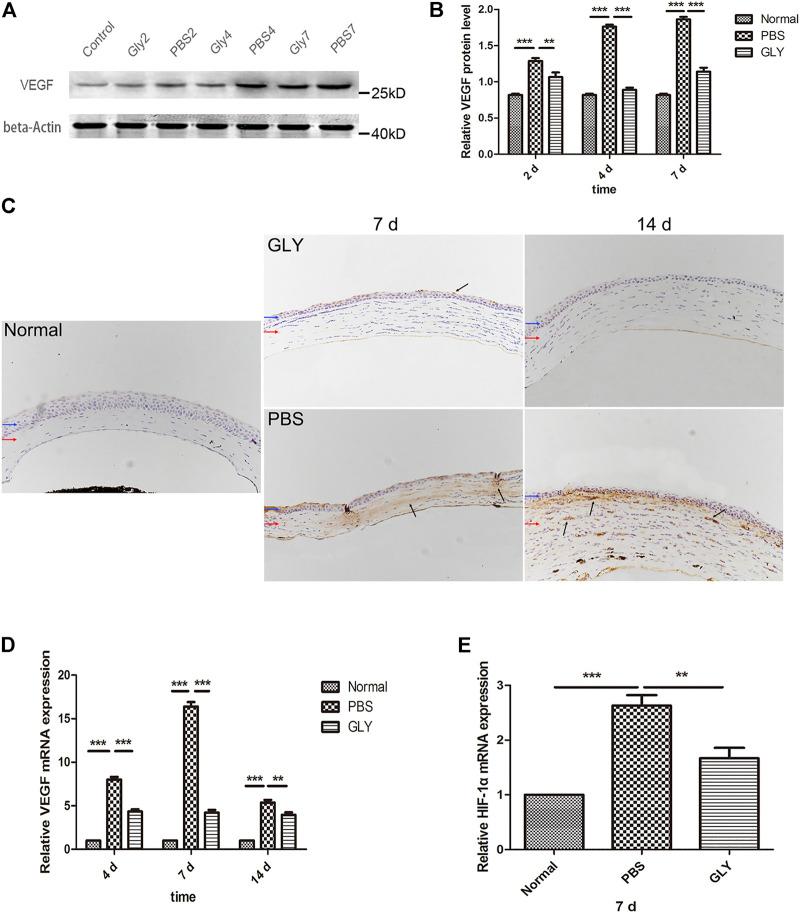 https://cdn.ncbi.nlm.nih.gov/pmc/blobs/29c8/9108160/f9aea3713253/fphar-13-841267-g003.jpg