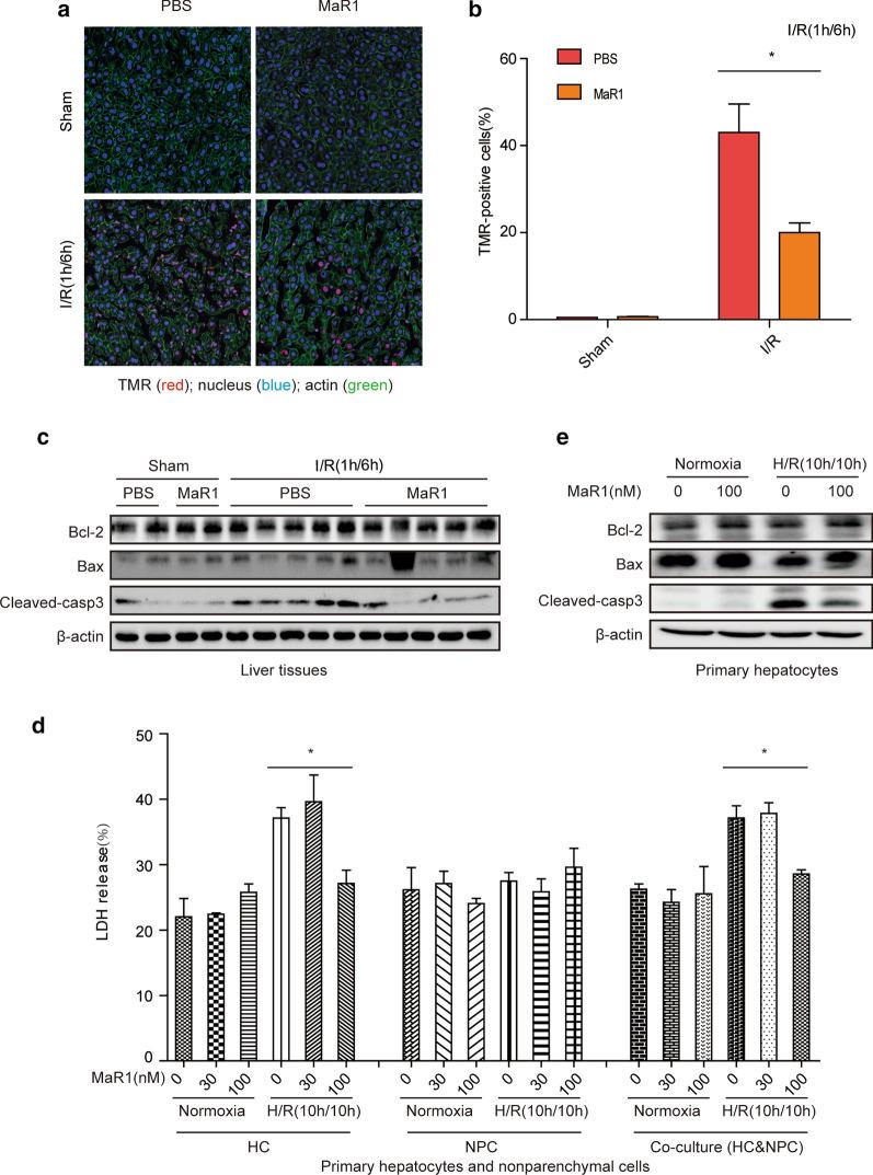https://cdn.ncbi.nlm.nih.gov/pmc/blobs/29c9/7905895/246413fdcfff/10020_2021_280_Fig2_HTML.jpg