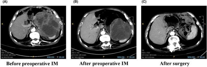 https://cdn.ncbi.nlm.nih.gov/pmc/blobs/29cb/11413410/3c28b41ae6a9/CAM4-13-e70237-g003.jpg