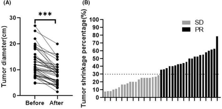 https://cdn.ncbi.nlm.nih.gov/pmc/blobs/29cb/11413410/fe5c7182a4c2/CAM4-13-e70237-g005.jpg