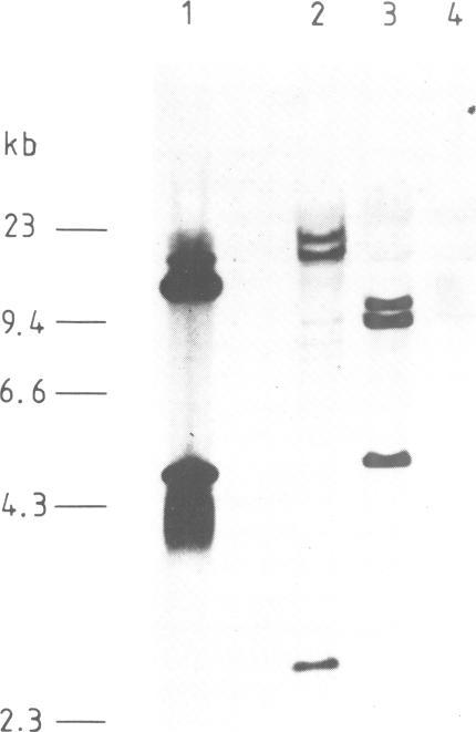 https://cdn.ncbi.nlm.nih.gov/pmc/blobs/29cf/400813/d3b12b548bb6/emboj00126-0028-b.jpg