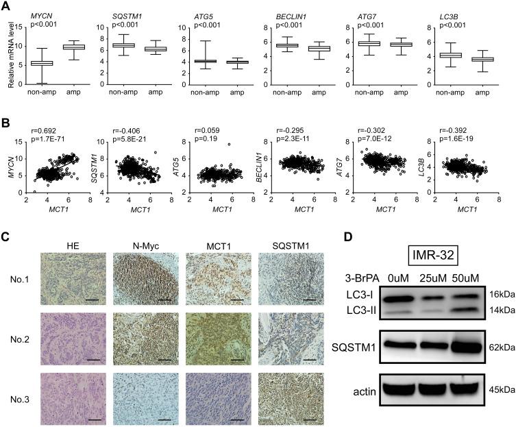 https://cdn.ncbi.nlm.nih.gov/pmc/blobs/29d2/7605667/300bf88a07fd/OTT-13-11125-g0002.jpg